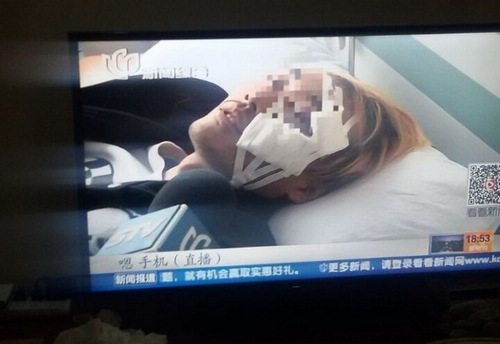 炉石传说主播熊大车祸